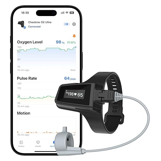 Wellue O2Ring 100H Continuous Oximeter