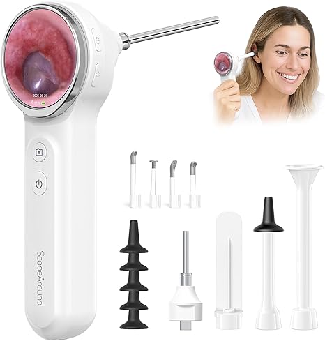 ScopeAround Wi-Fi Digital Ear Otoscope